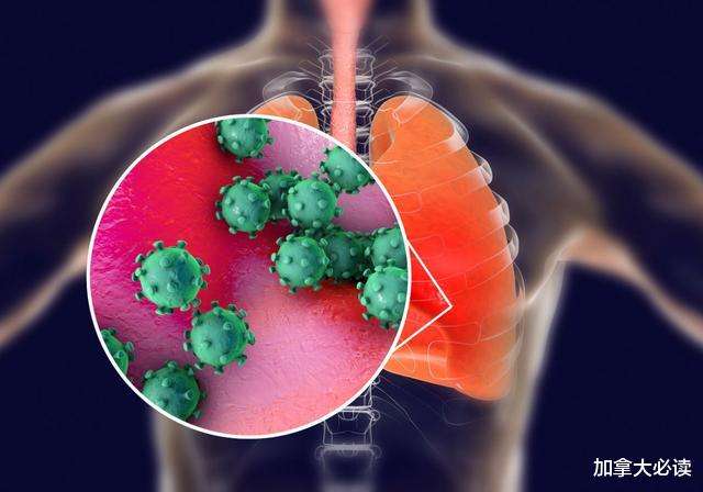 新冠病毒是种什么病 新冠病毒感染是什么病